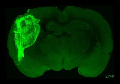 a section of a rat brain is imaged in dull green. a much brighter green human organoid takes up a large portion of the left side of the brain.